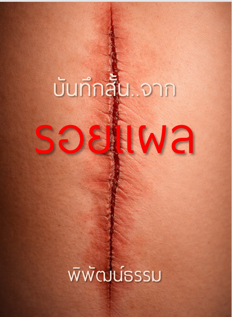 บันทึกสั้น… จากรอยแผล